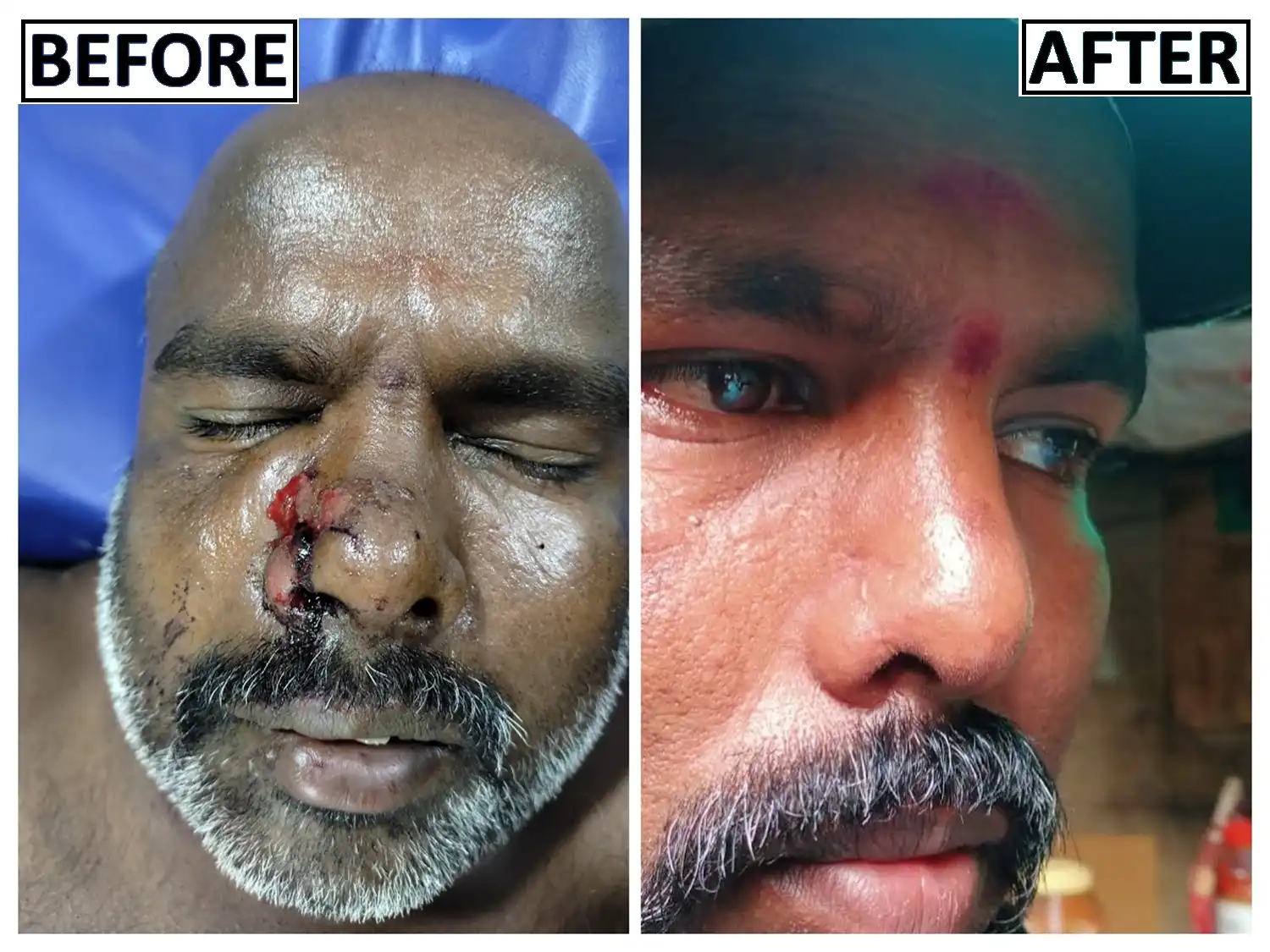 Face Trauma