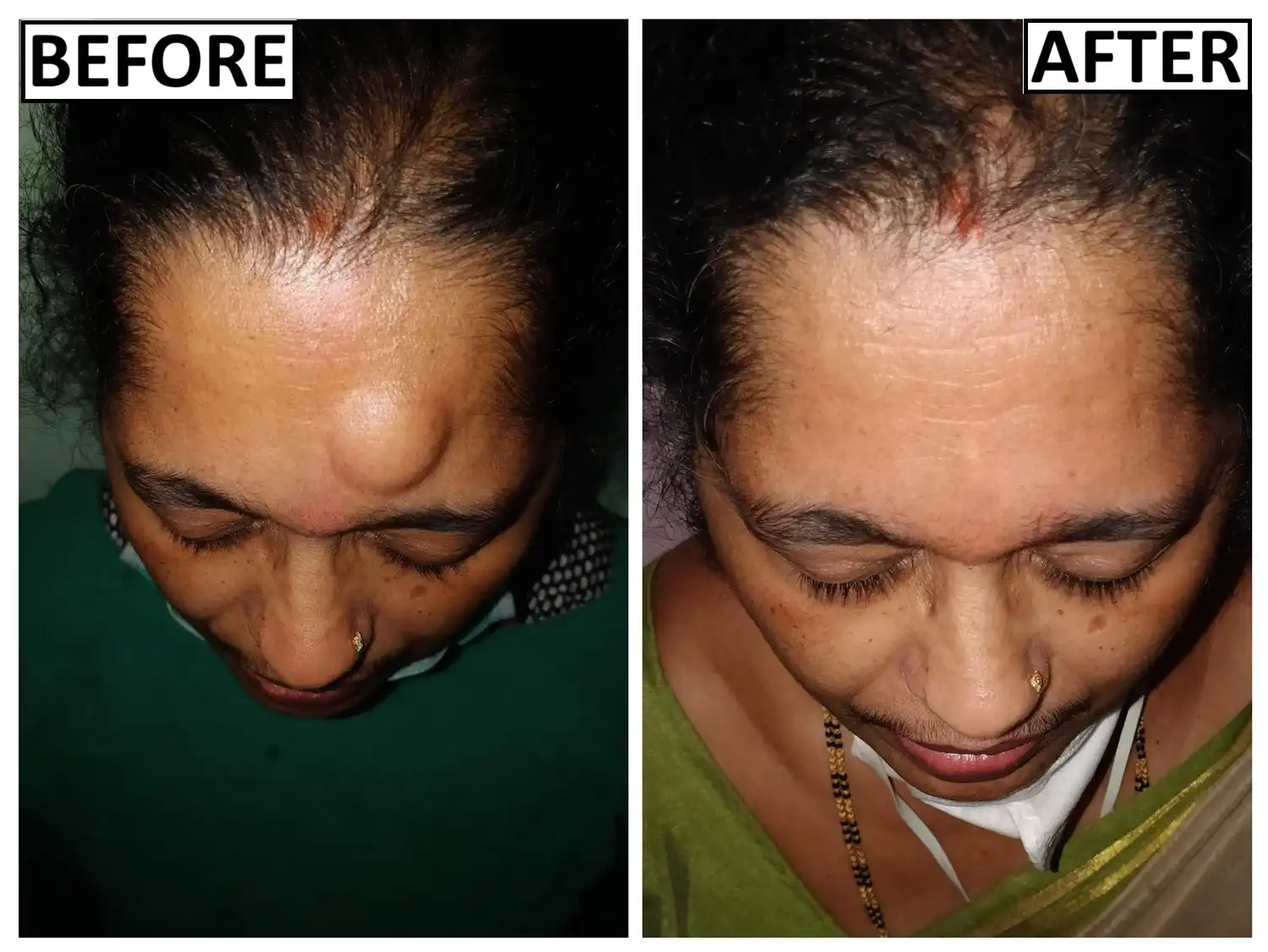 Treatment showcase image 6